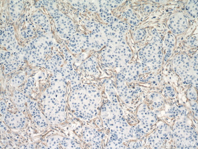 Vimentin Antibody in Immunohistochemistry (Paraffin) (IHC (P))