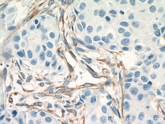 Vimentin Antibody in Immunohistochemistry (Paraffin) (IHC (P))