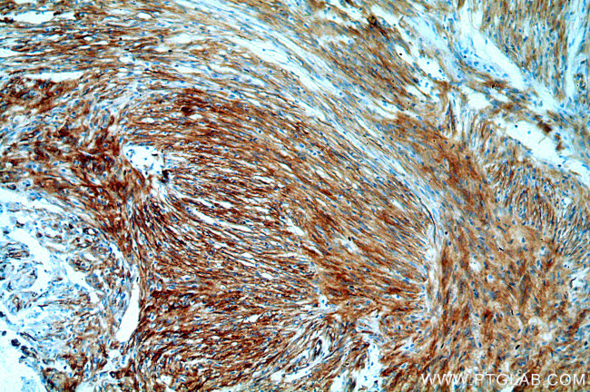 Vimentin Antibody in Immunohistochemistry (Paraffin) (IHC (P))