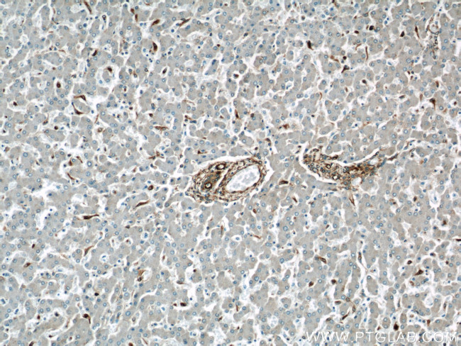 Vimentin Antibody in Immunohistochemistry (Paraffin) (IHC (P))