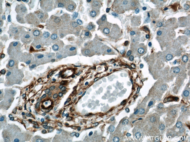 Vimentin Antibody in Immunohistochemistry (Paraffin) (IHC (P))