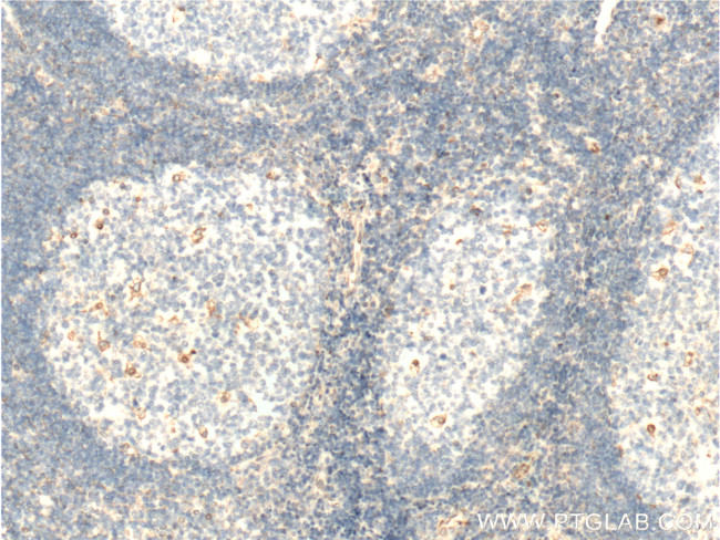 Vimentin Antibody in Immunohistochemistry (Paraffin) (IHC (P))