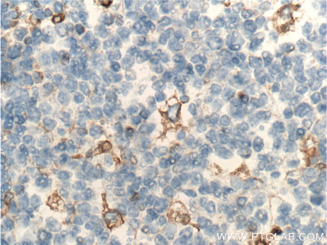 Vimentin Antibody in Immunohistochemistry (Paraffin) (IHC (P))