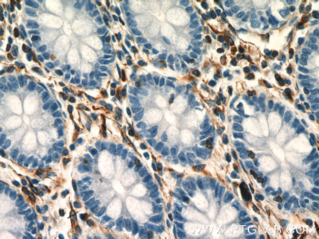 Vimentin Antibody in Immunohistochemistry (Paraffin) (IHC (P))