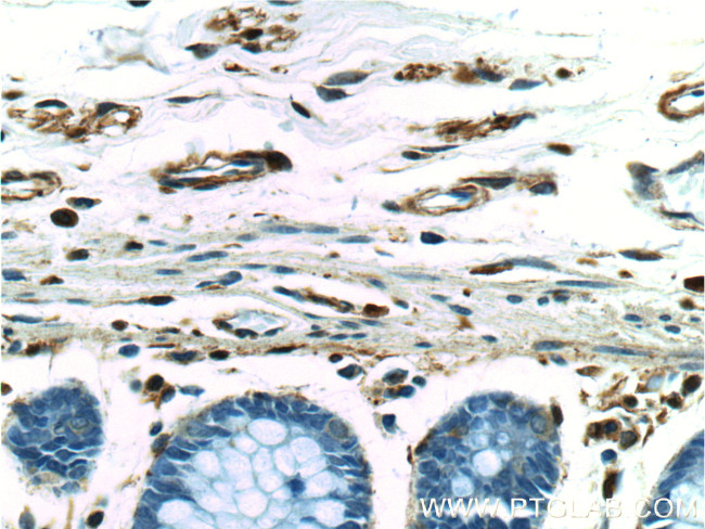 Vimentin Antibody in Immunohistochemistry (Paraffin) (IHC (P))