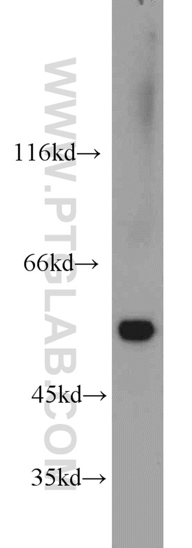 Vimentin Antibody in Western Blot (WB)