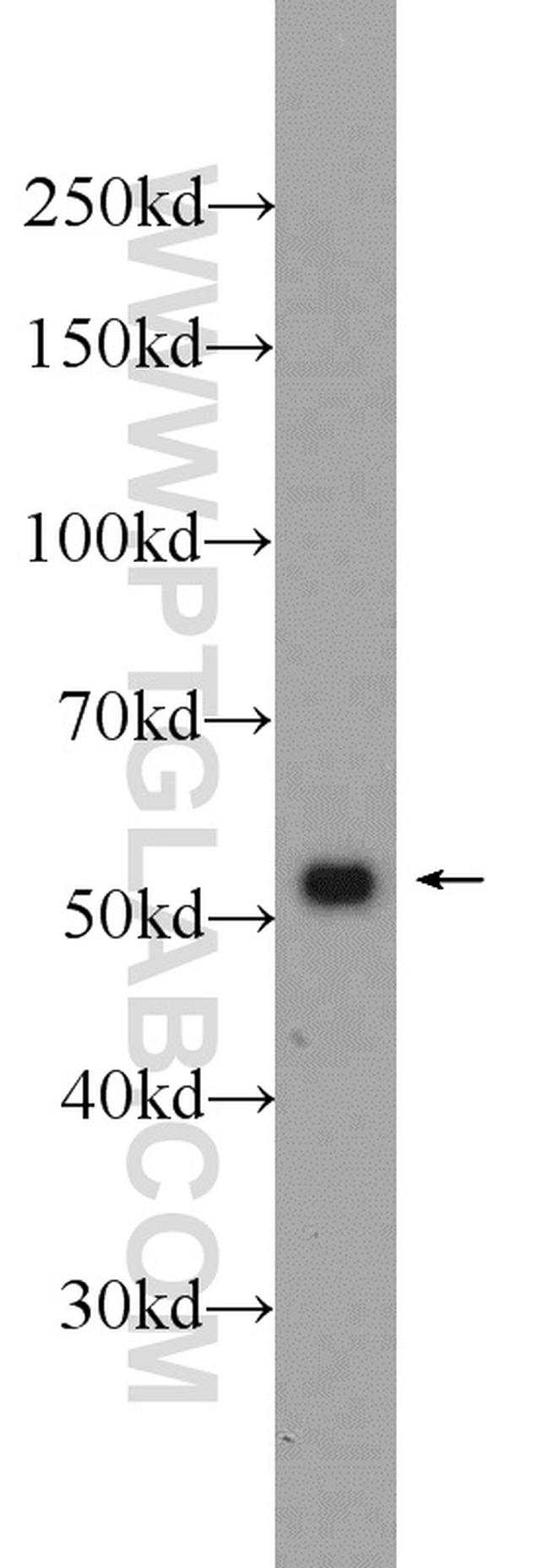 Vimentin Antibody in Western Blot (WB)