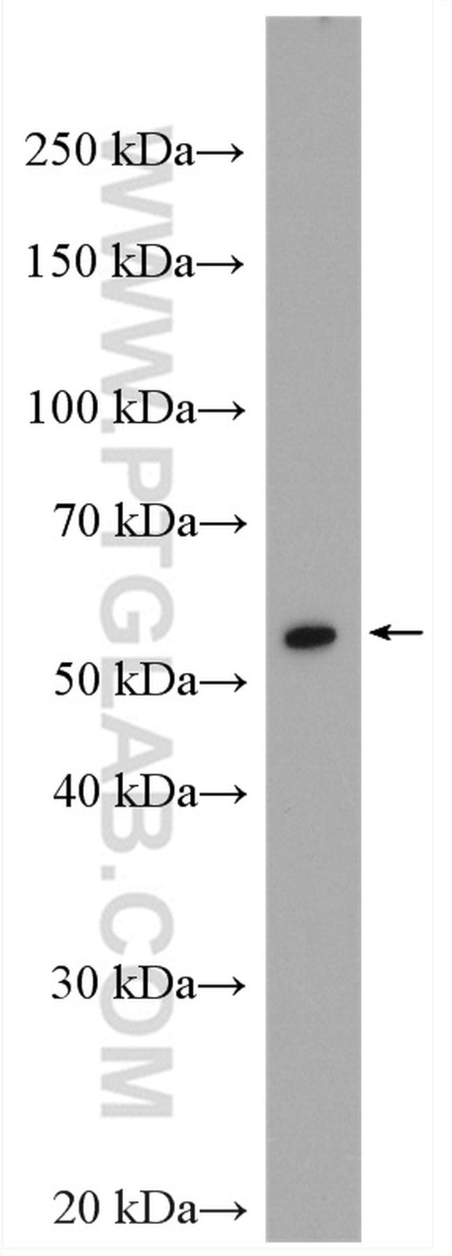 Vimentin Antibody in Western Blot (WB)