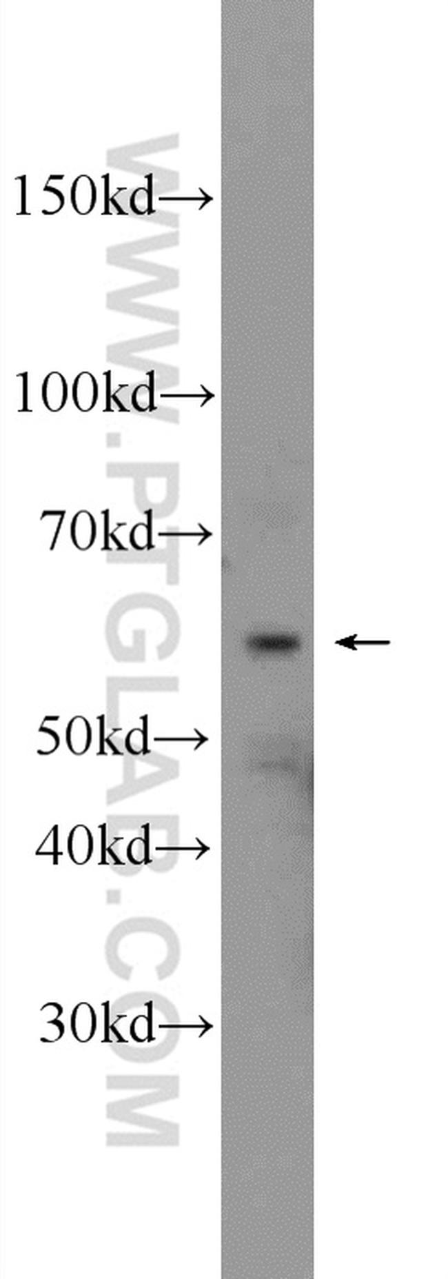 Vimentin Antibody in Western Blot (WB)