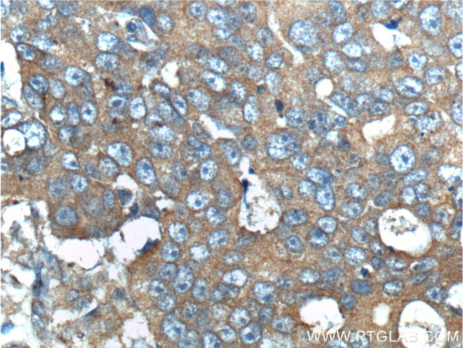 ERBB3 Antibody in Immunohistochemistry (Paraffin) (IHC (P))