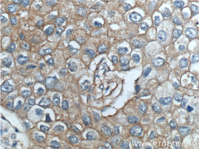 ERBB3 Antibody in Immunohistochemistry (Paraffin) (IHC (P))