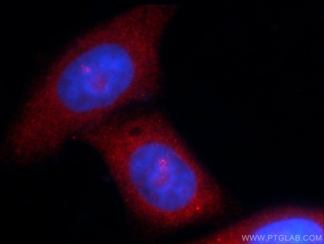 MOV10 Antibody in Immunocytochemistry (ICC/IF)