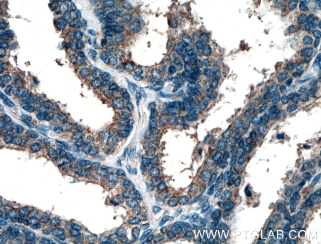 MOV10 Antibody in Immunohistochemistry (Paraffin) (IHC (P))