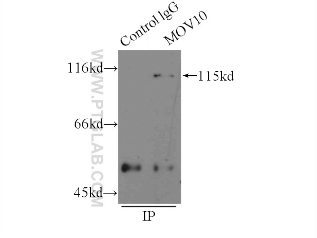 MOV10 Antibody in Immunoprecipitation (IP)