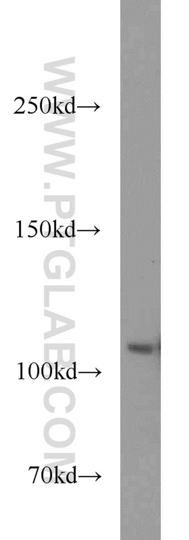 MOV10 Antibody in Western Blot (WB)