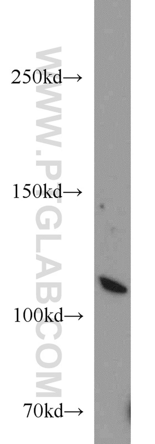 MOV10 Antibody in Western Blot (WB)