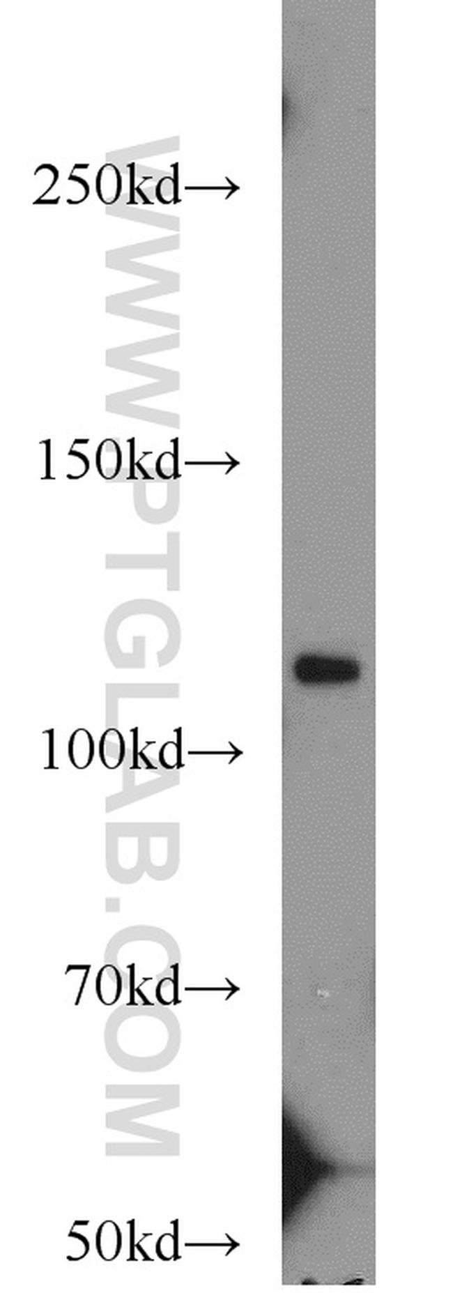 MOV10 Antibody in Western Blot (WB)