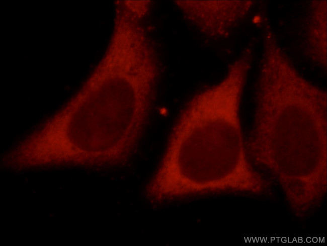 MMP1 Antibody in Immunocytochemistry (ICC/IF)