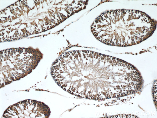 MMP1 Antibody in Immunohistochemistry (Paraffin) (IHC (P))