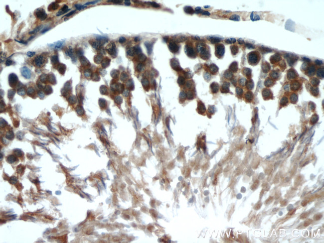 MMP1 Antibody in Immunohistochemistry (Paraffin) (IHC (P))