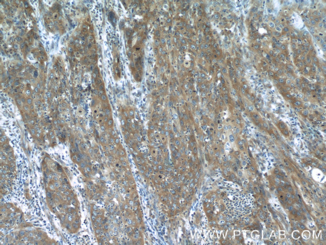 MMP1 Antibody in Immunohistochemistry (Paraffin) (IHC (P))