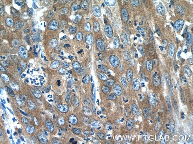 MMP1 Antibody in Immunohistochemistry (Paraffin) (IHC (P))