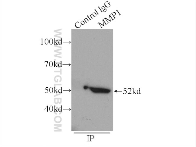 MMP1 Antibody in Immunoprecipitation (IP)