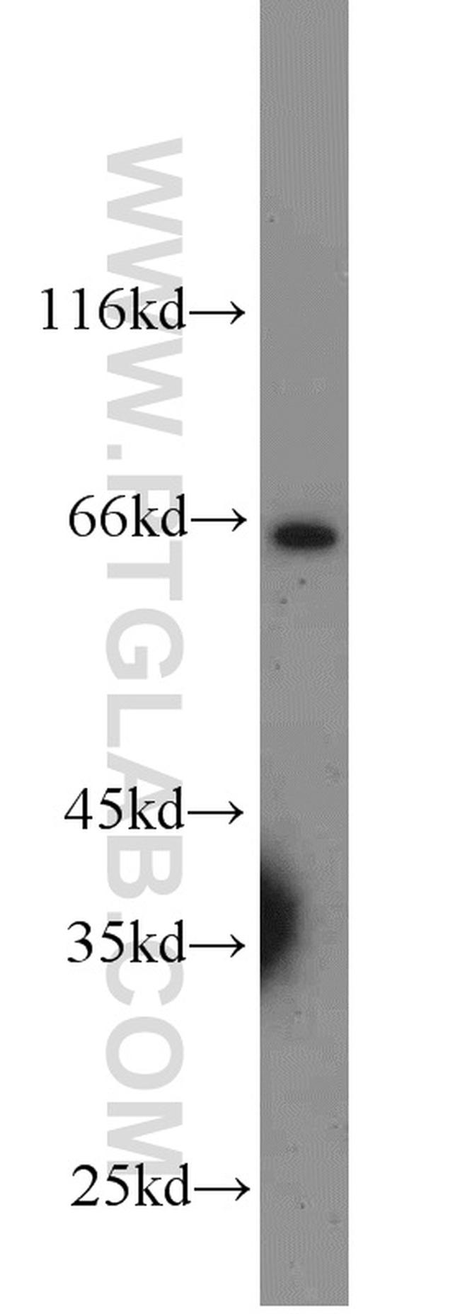 MMP1 Antibody in Western Blot (WB)