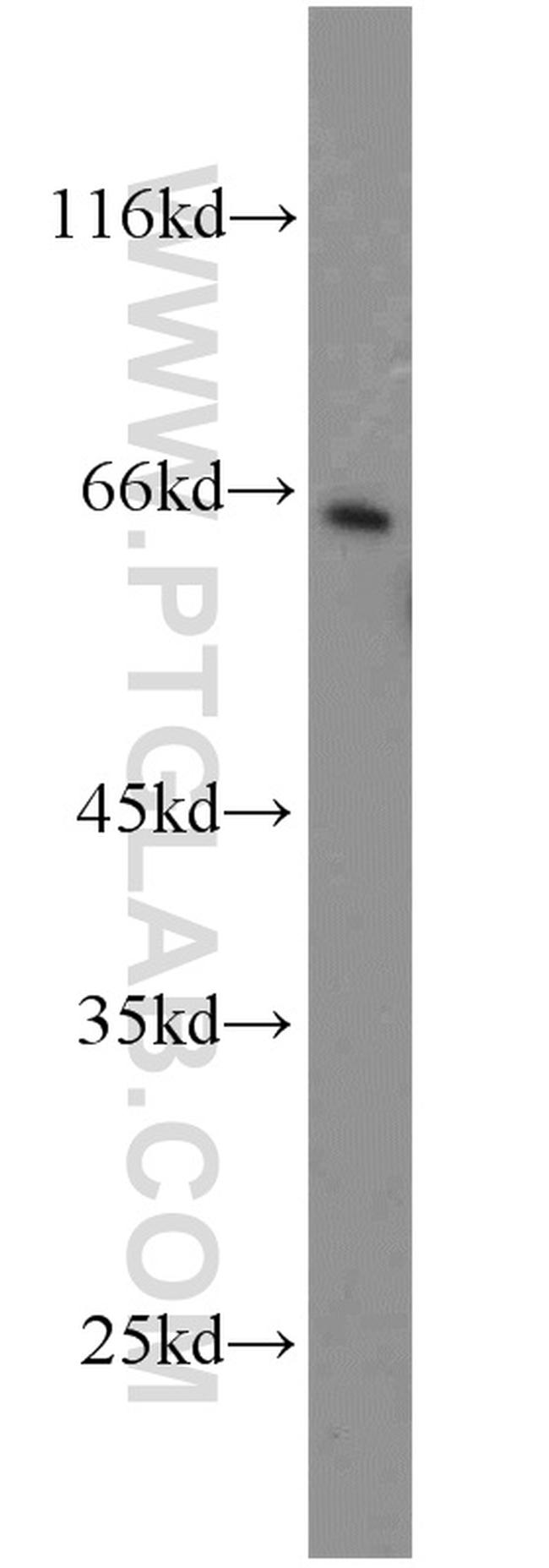 MMP1 Antibody in Western Blot (WB)