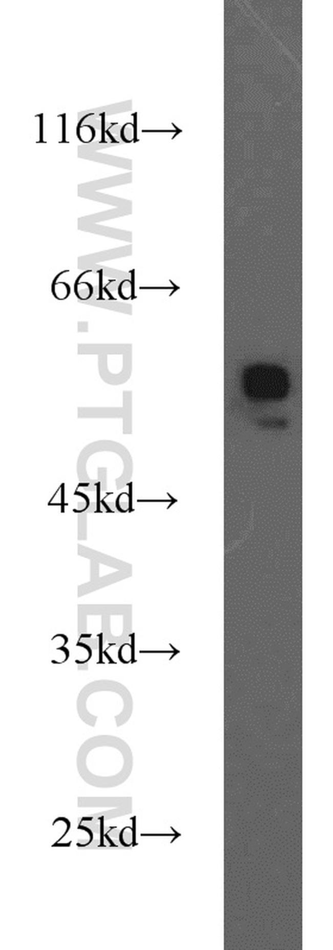 MMP1 Antibody in Western Blot (WB)