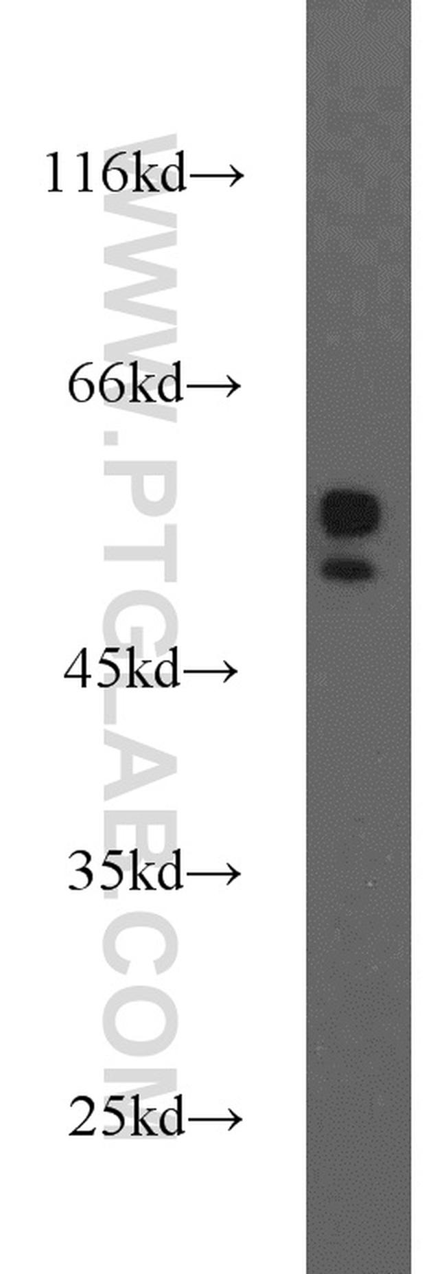 MMP1 Antibody in Western Blot (WB)