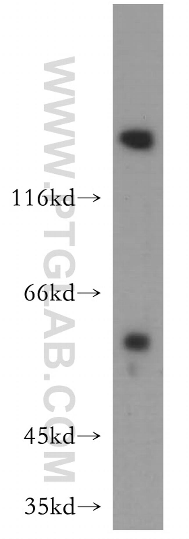 MMP1 Antibody in Western Blot (WB)