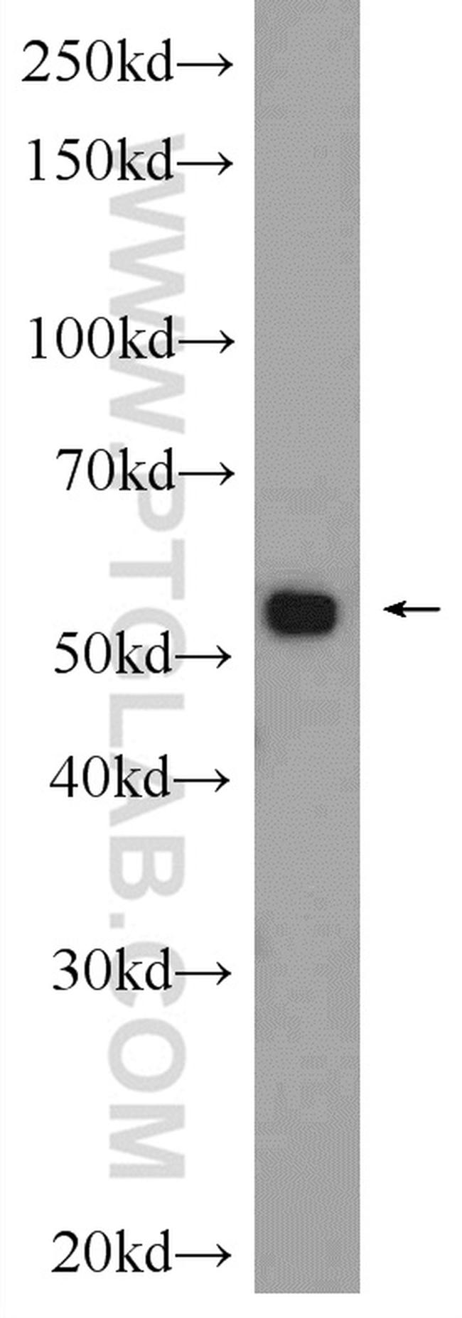 MMP1 Antibody in Western Blot (WB)