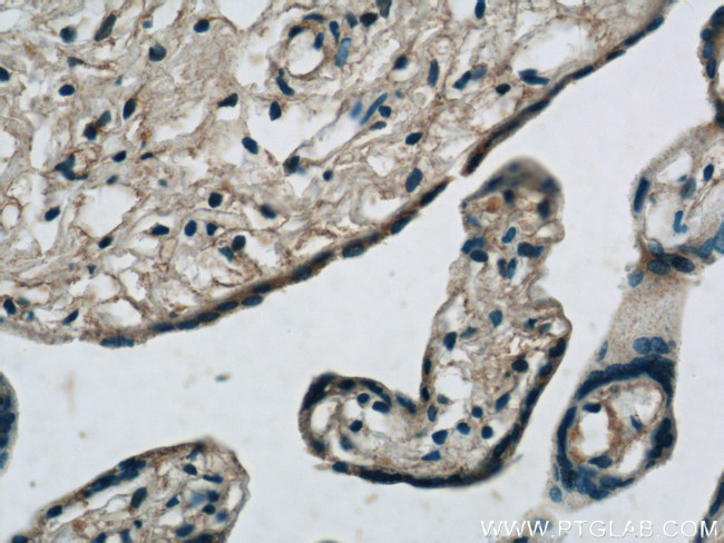 MMP2 Antibody in Immunohistochemistry (Paraffin) (IHC (P))