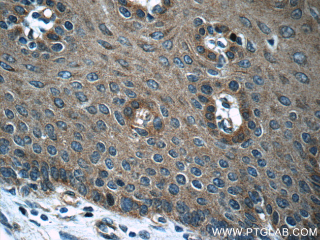 MMP2 Antibody in Immunohistochemistry (Paraffin) (IHC (P))