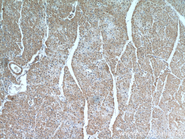 MMP2 Antibody in Immunohistochemistry (Paraffin) (IHC (P))