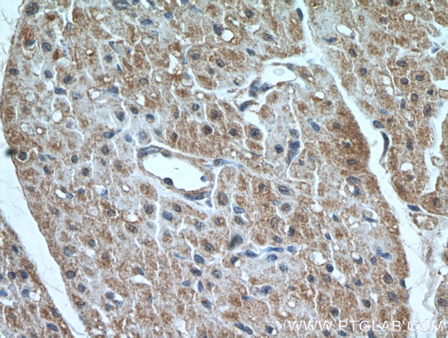 MMP2 Antibody in Immunohistochemistry (Paraffin) (IHC (P))