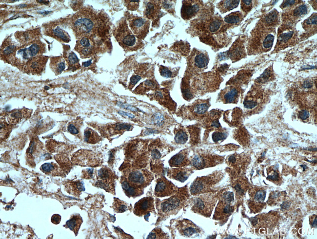 MMP2 Antibody in Immunohistochemistry (Paraffin) (IHC (P))