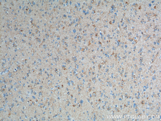 MMP2 Antibody in Immunohistochemistry (Paraffin) (IHC (P))