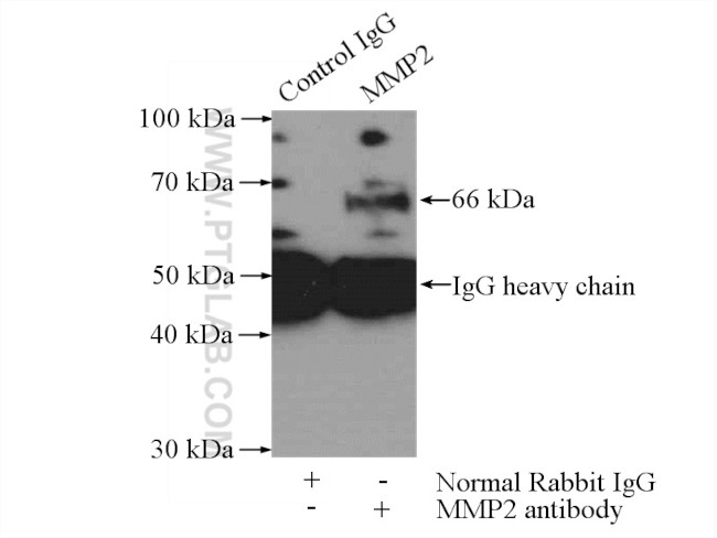 MMP2 Antibody in Immunoprecipitation (IP)