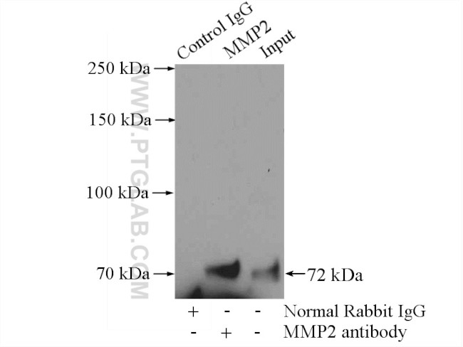 MMP2 Antibody in Immunoprecipitation (IP)