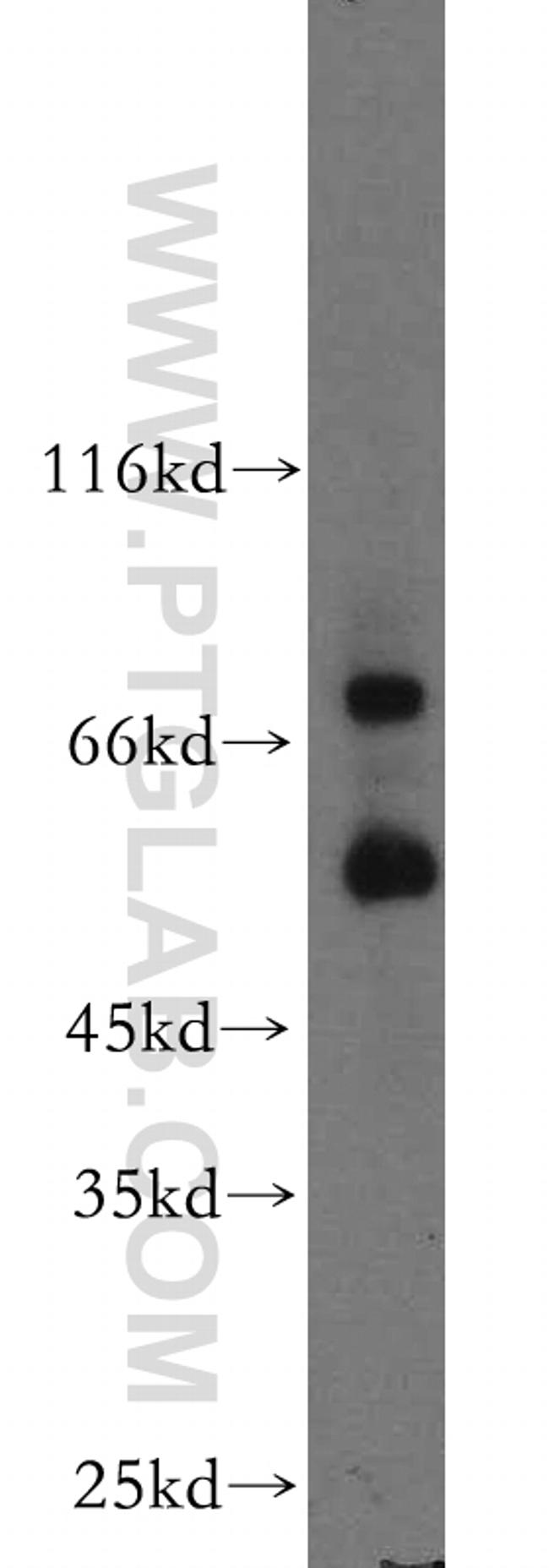 MMP2 Antibody in Western Blot (WB)