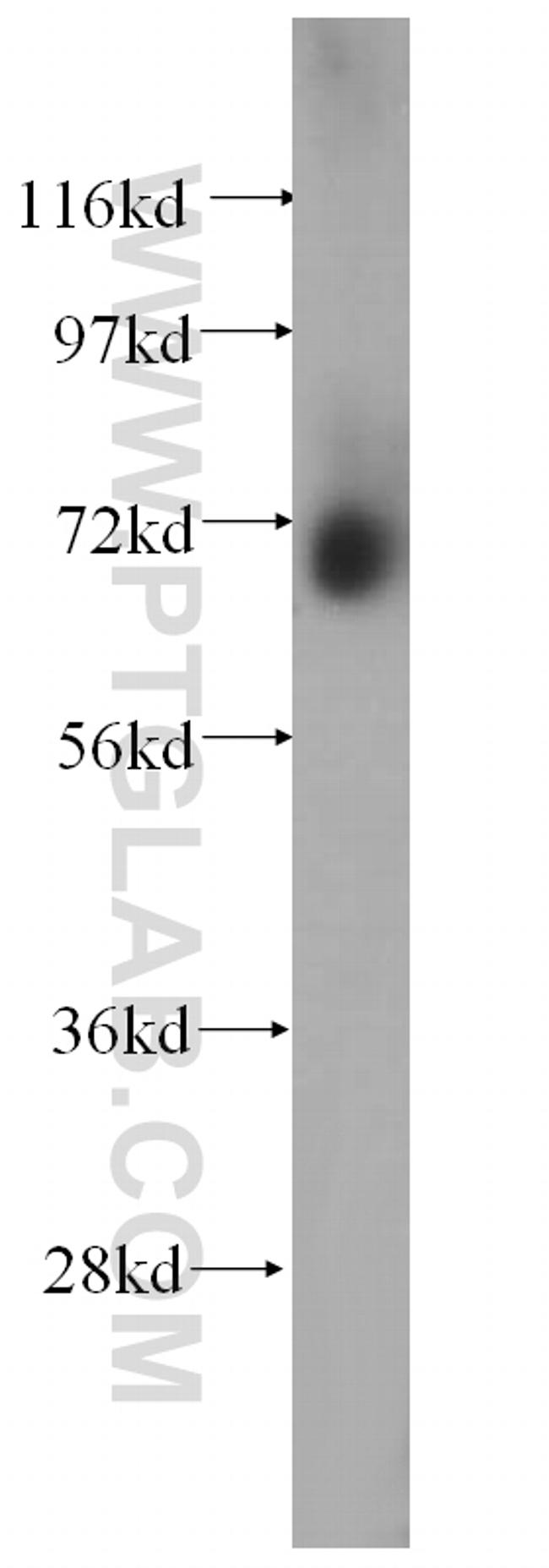 MMP2 Antibody in Western Blot (WB)