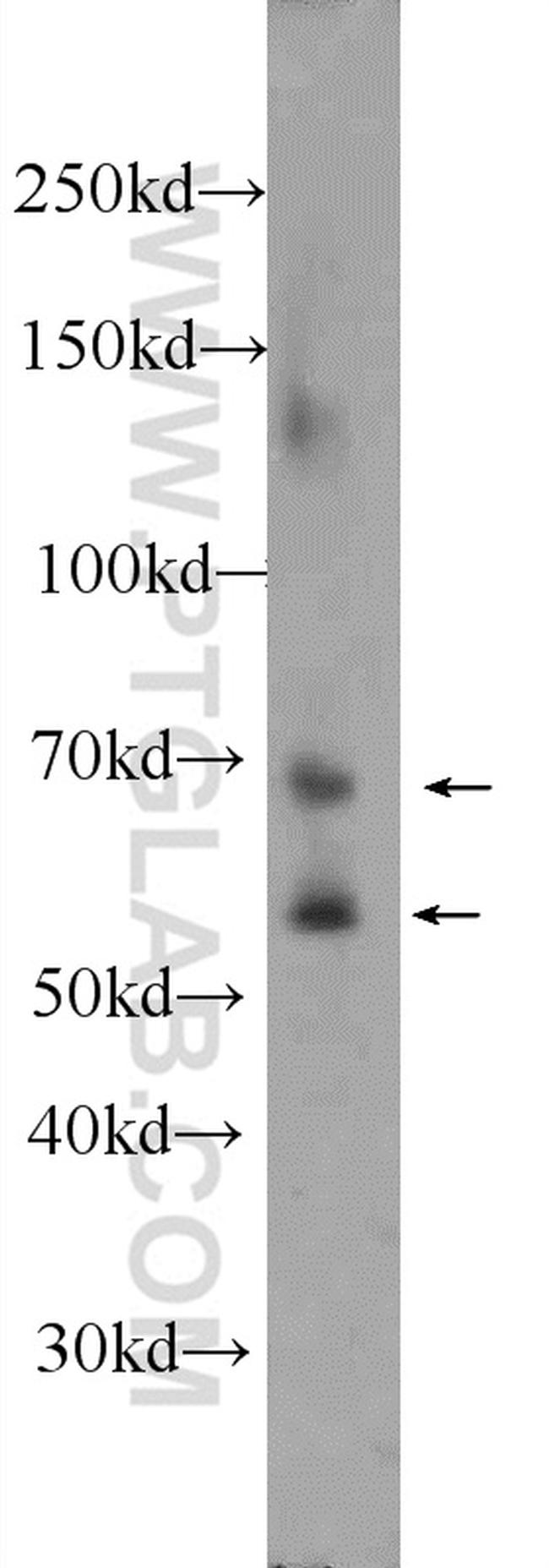 MMP2 Antibody in Western Blot (WB)