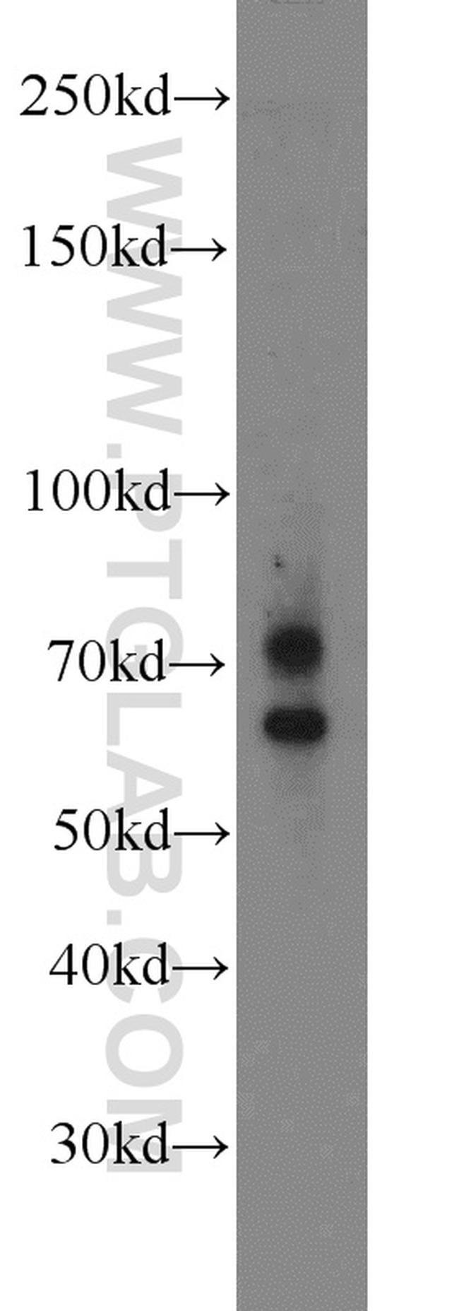 MMP2 Antibody in Western Blot (WB)