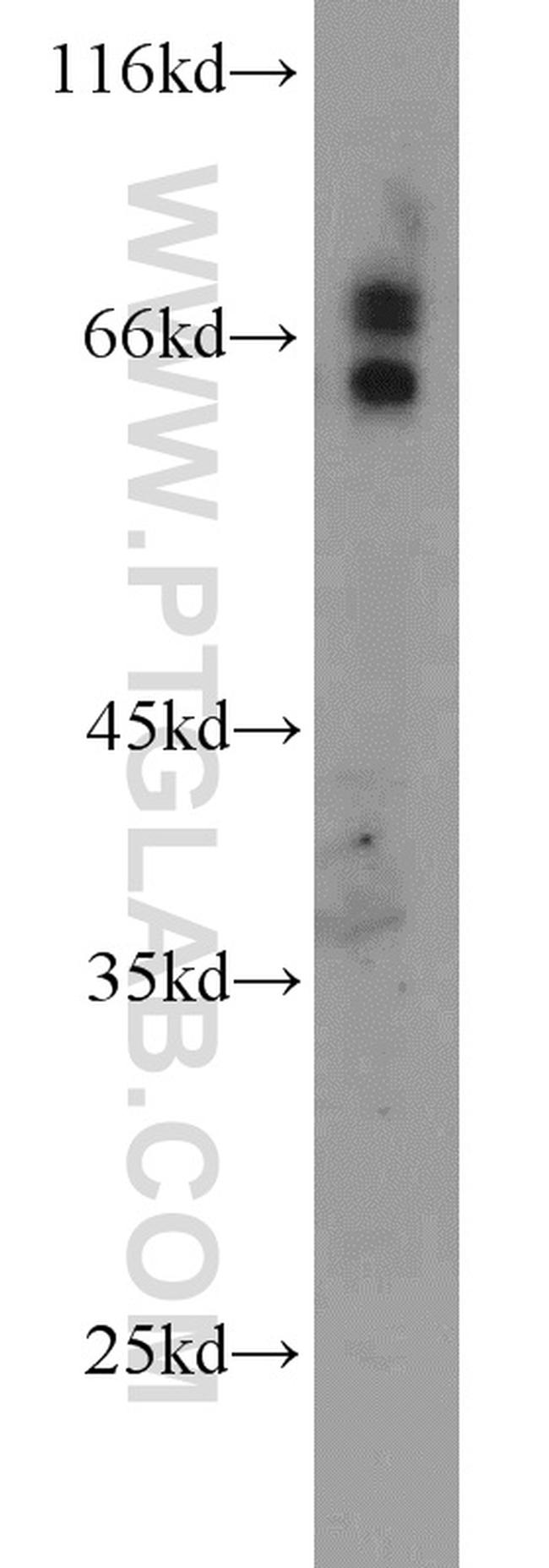 MMP2 Antibody in Western Blot (WB)