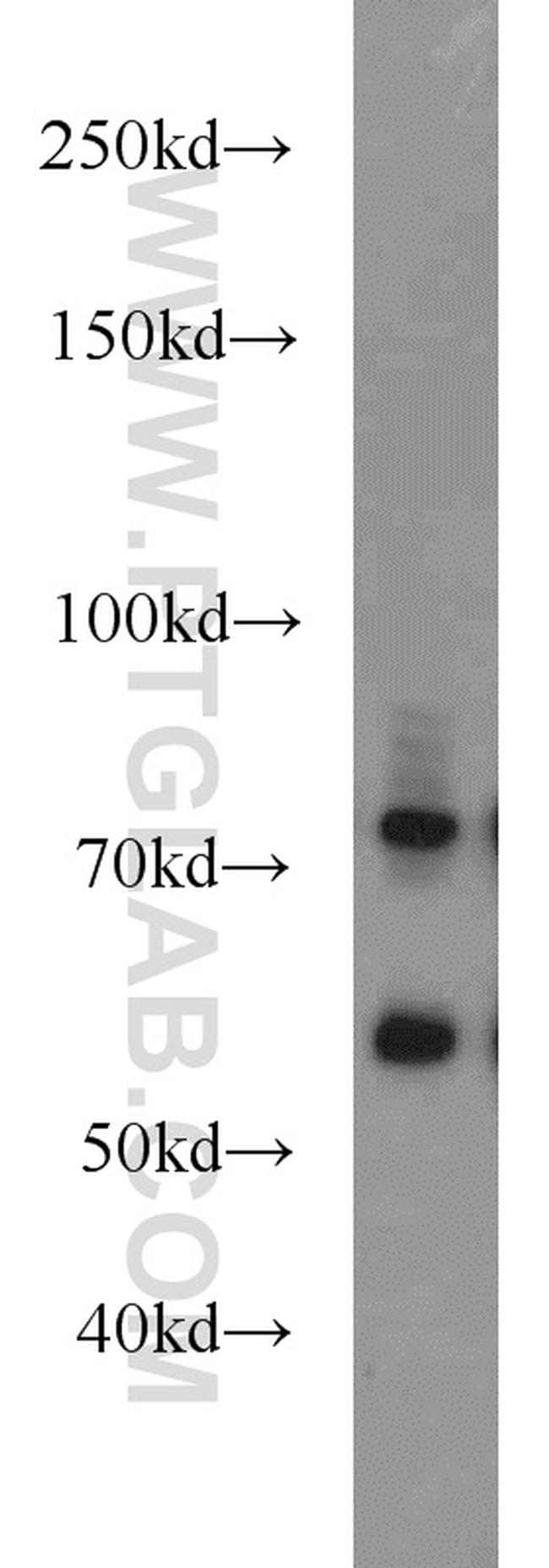 MMP2 Antibody in Western Blot (WB)