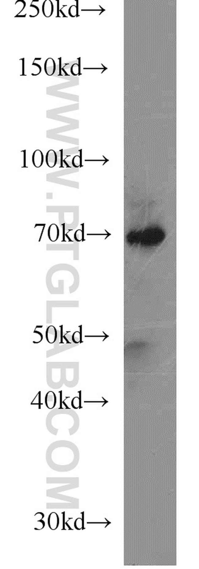 MMP2 Antibody in Western Blot (WB)