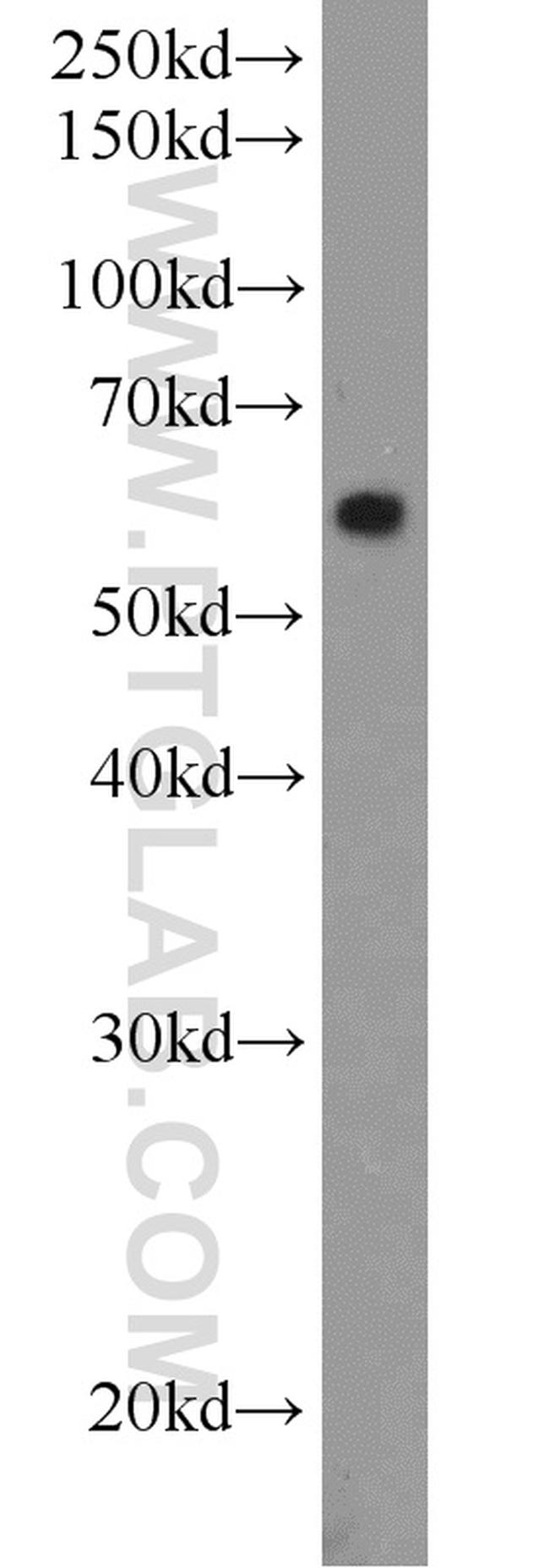 MMP2 Antibody in Western Blot (WB)