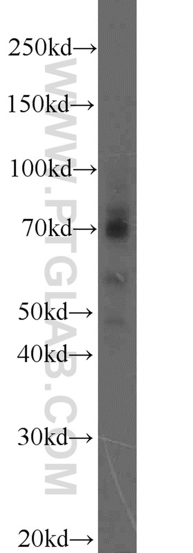 MMP2 Antibody in Western Blot (WB)